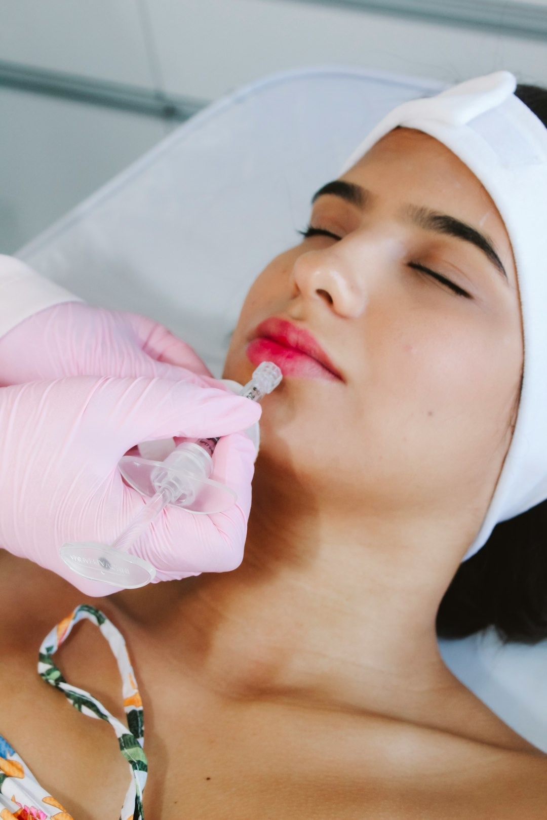 Lippenbehandlung mit Hyaluronsäure
